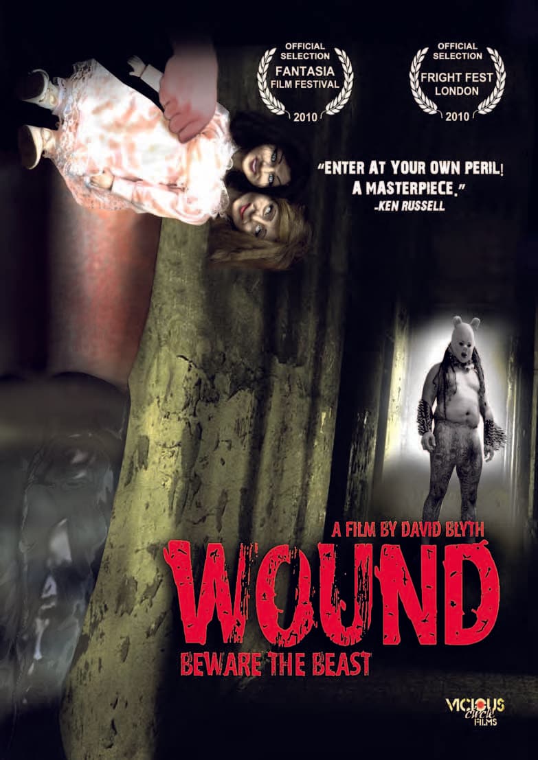 Wound